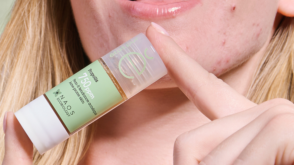 3 spersonalizowane rutyny pielęgnacyjne dla skóry trądzikowej